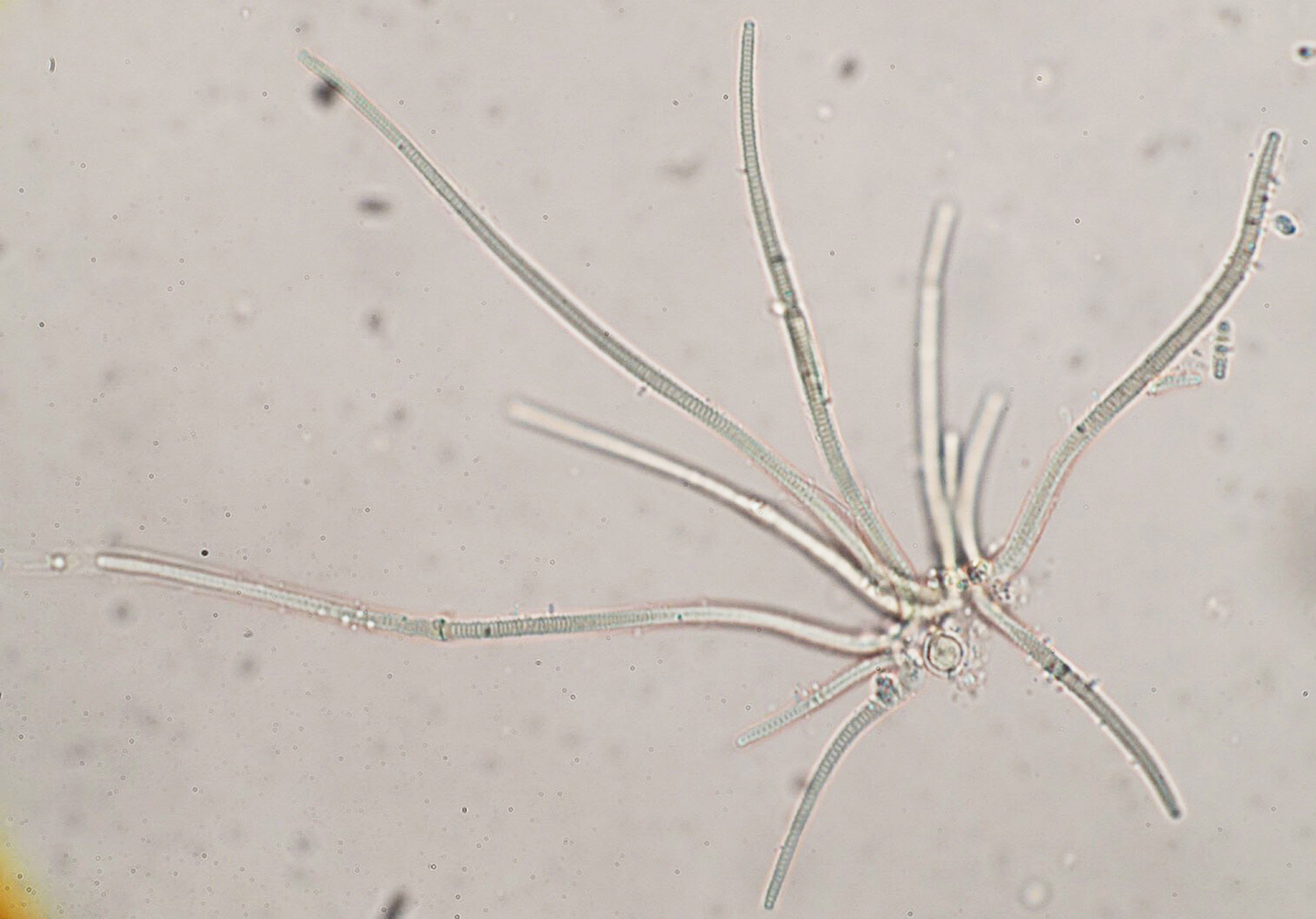 顕微鏡で撮影された糸状の構造を持つ藍藻が放射状に広がっている様子が捉えられている写真